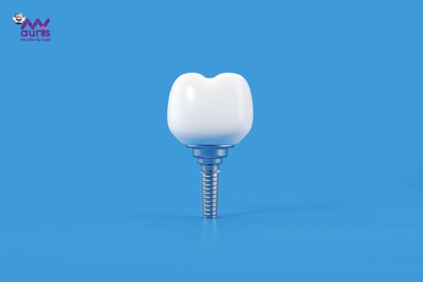  trồng răng công nghệ implant 