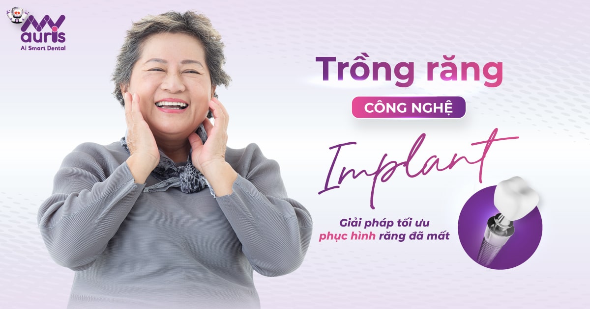 Trồng răng công nghệ implant