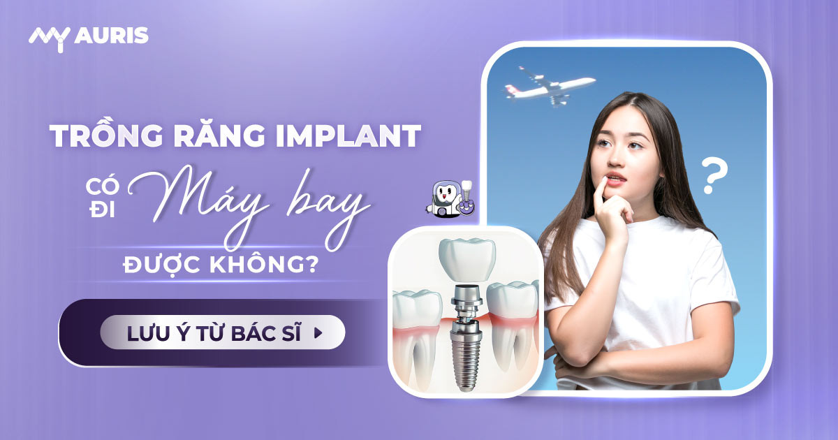 trồng răng implant có đi máy bay được không