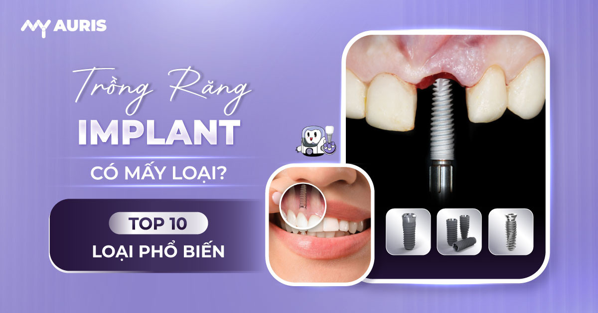trồng răng implant có mấy loại,cấy implant loại nào tốt,hậu quả trồng răng sứ,nên cắm implant loại nào,trồng răng có mấy loại,trồng răng implant loại nào tốt