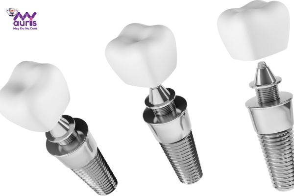  trồng răng implant mỹ 
