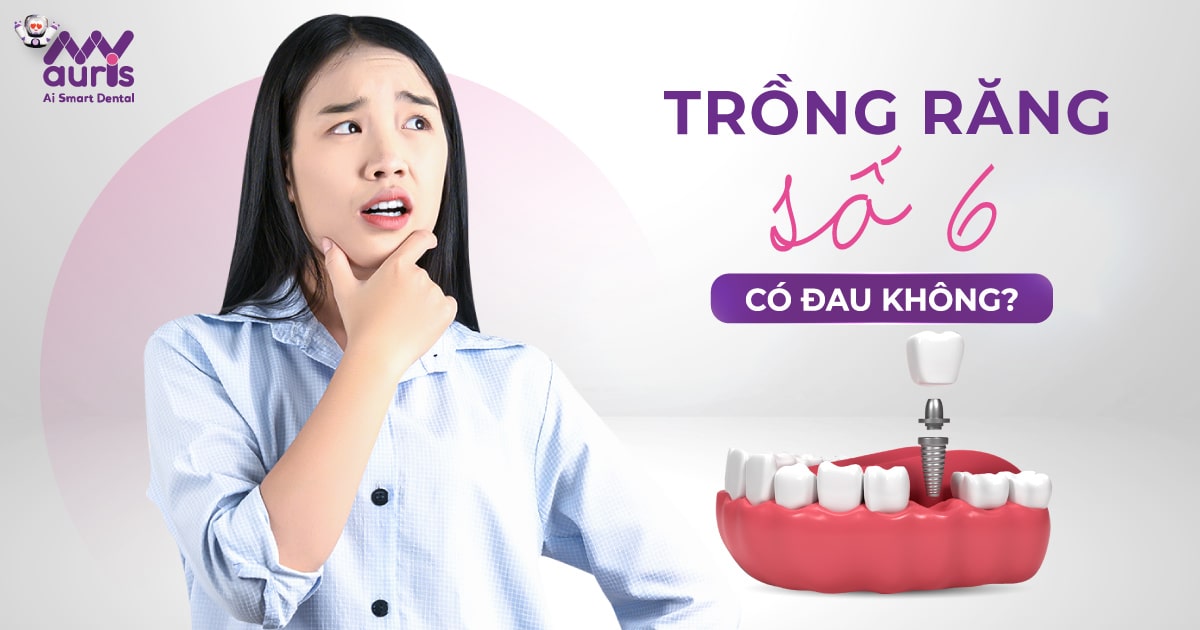 [Tư vấn nha khoa] Trồng răng số 6 có đau không?