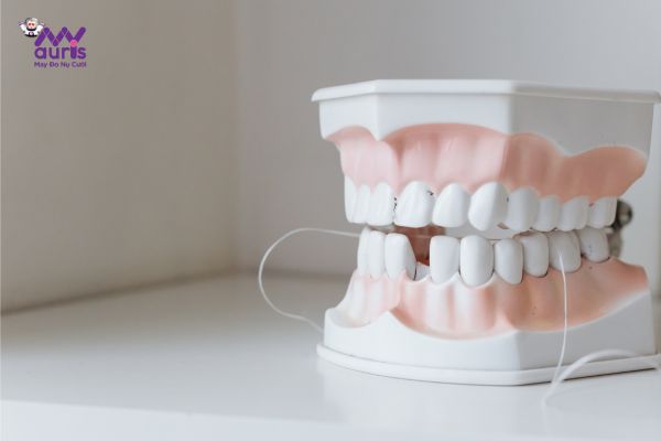 chi phí trồng răng giả implant giá bao nhiêu