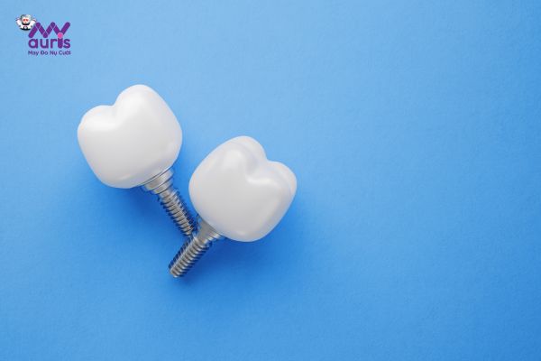 Chi phí trồng răng giả implant giá bao nhiêu?