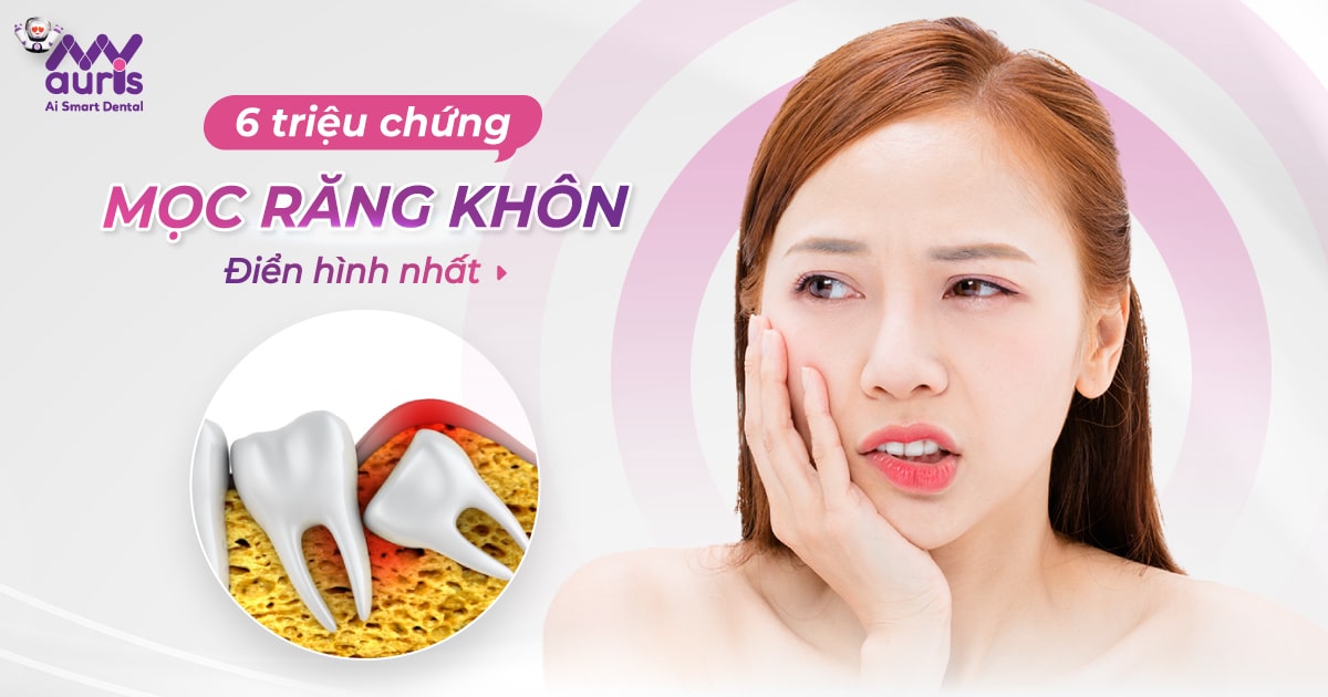 6 triệu chứng mọc răng khôn điển hình nhất