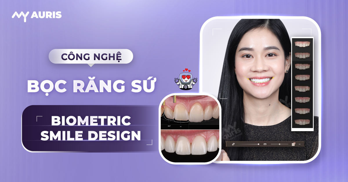 BioMetric Smile Design,BioMetric Smile Design là gì, nha khoa thẩm mỹ cao cấp ,bọc sứ VIP