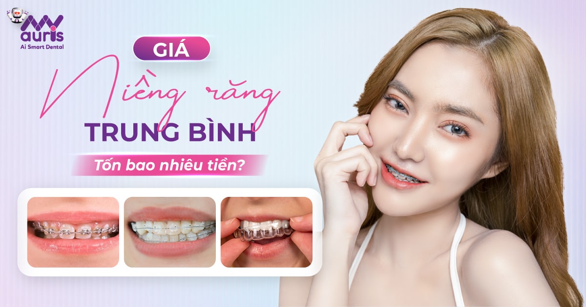 giá niềng răng trung bình