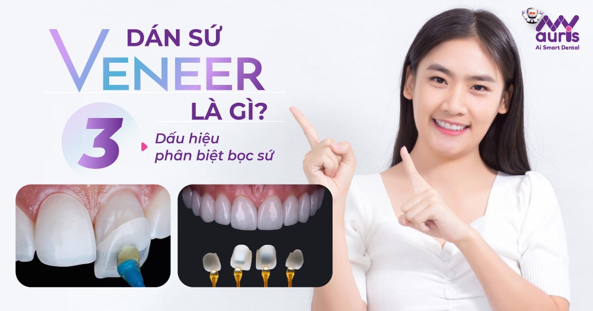 dán sứ veneer là gì