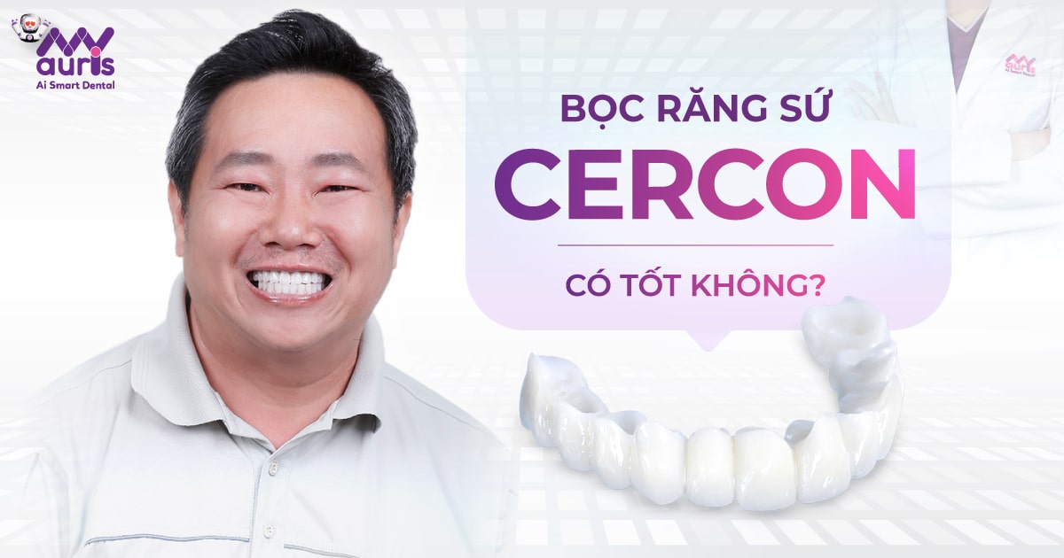 bọc răng sứ cercon có tốt không