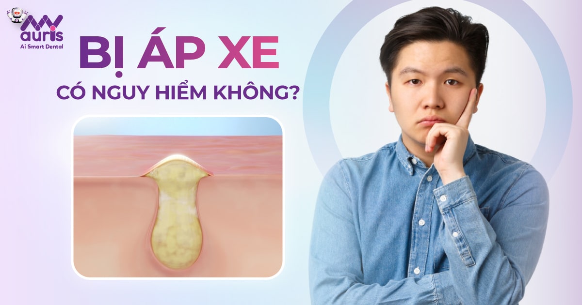 bị áp xe có nguy hiểm không