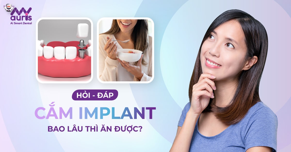 cắm implant bao lâu ăn được