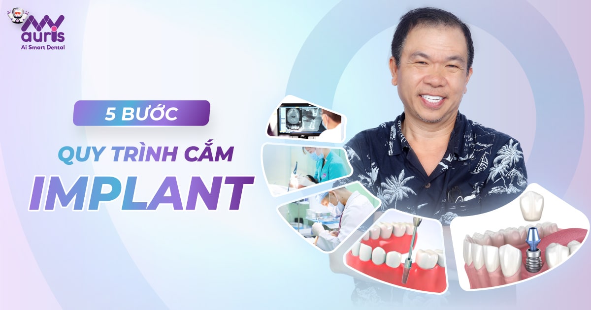 cắm răng sứ implant