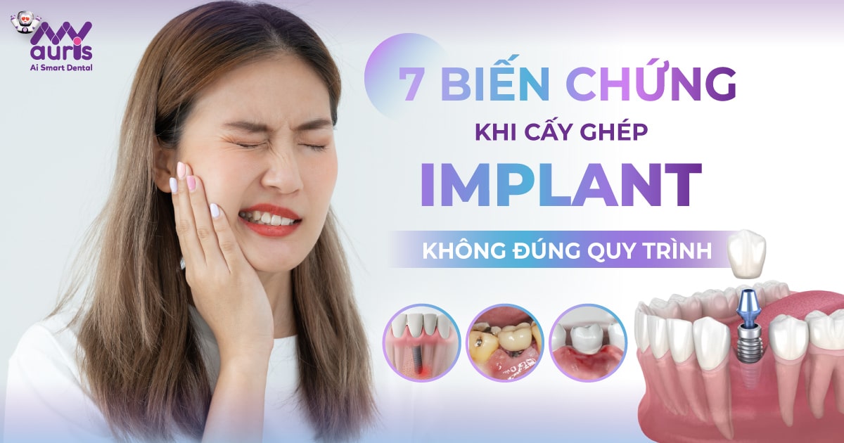 cấy ghép implant không đúng quy trình