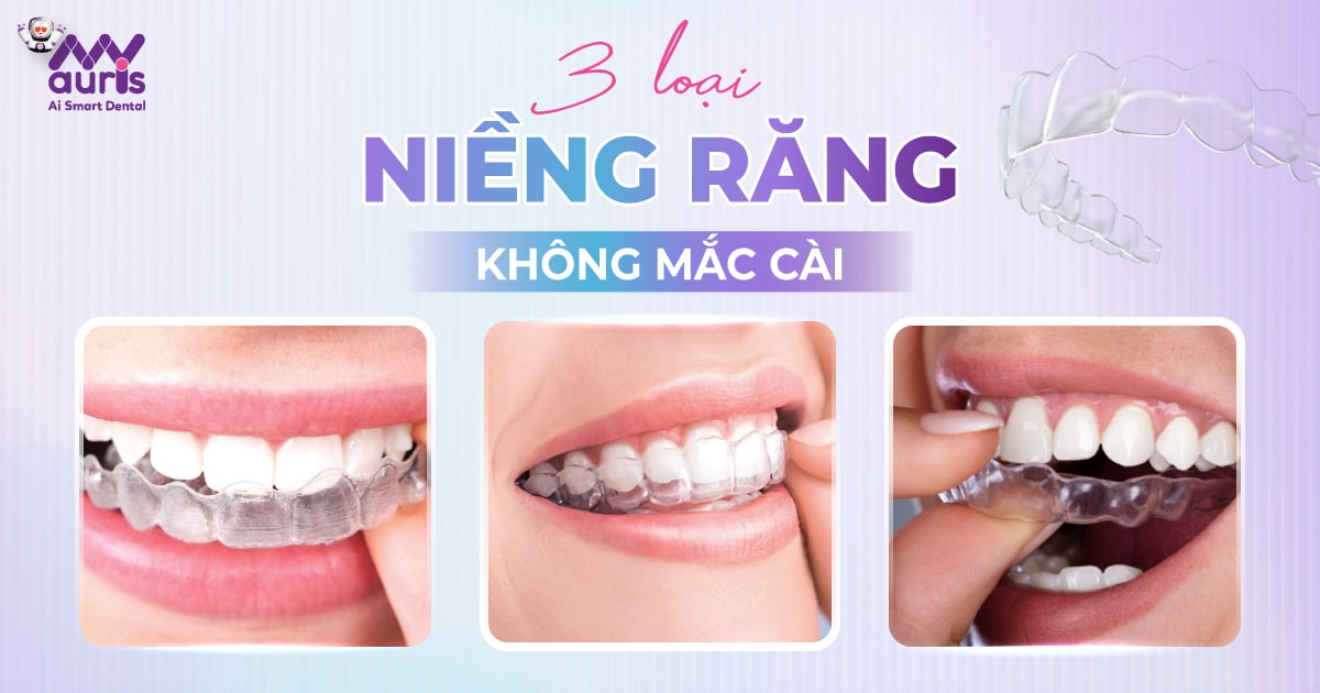 niềng răng không cần mắc cài