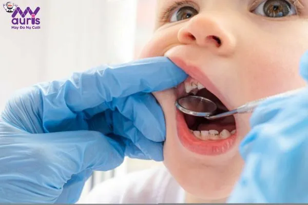 Nguyên nhân bé bị sâu răng hàm phổ biến hiện nay 