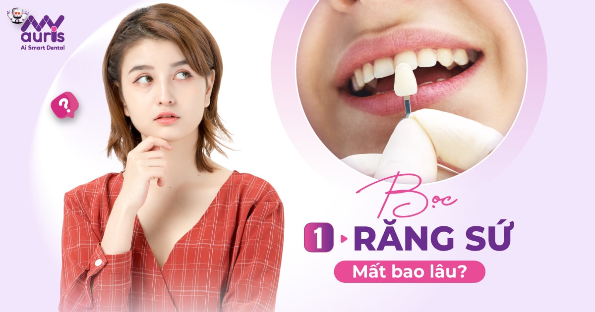 Bọc 1 răng sứ mất bao lâu? 4 điểm ảnh hưởng thời gian