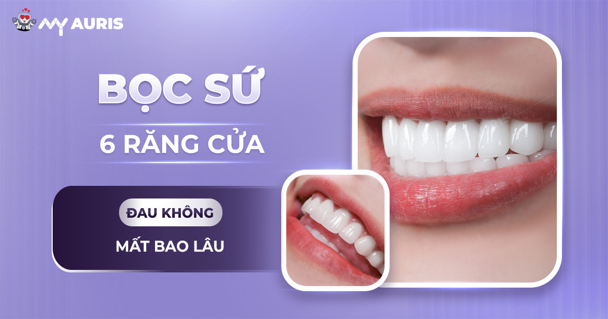 bọc sứ 6 răng cửa,làm 6 răng sứ,làm răng cửa sứ,làm răng sứ răng cửa