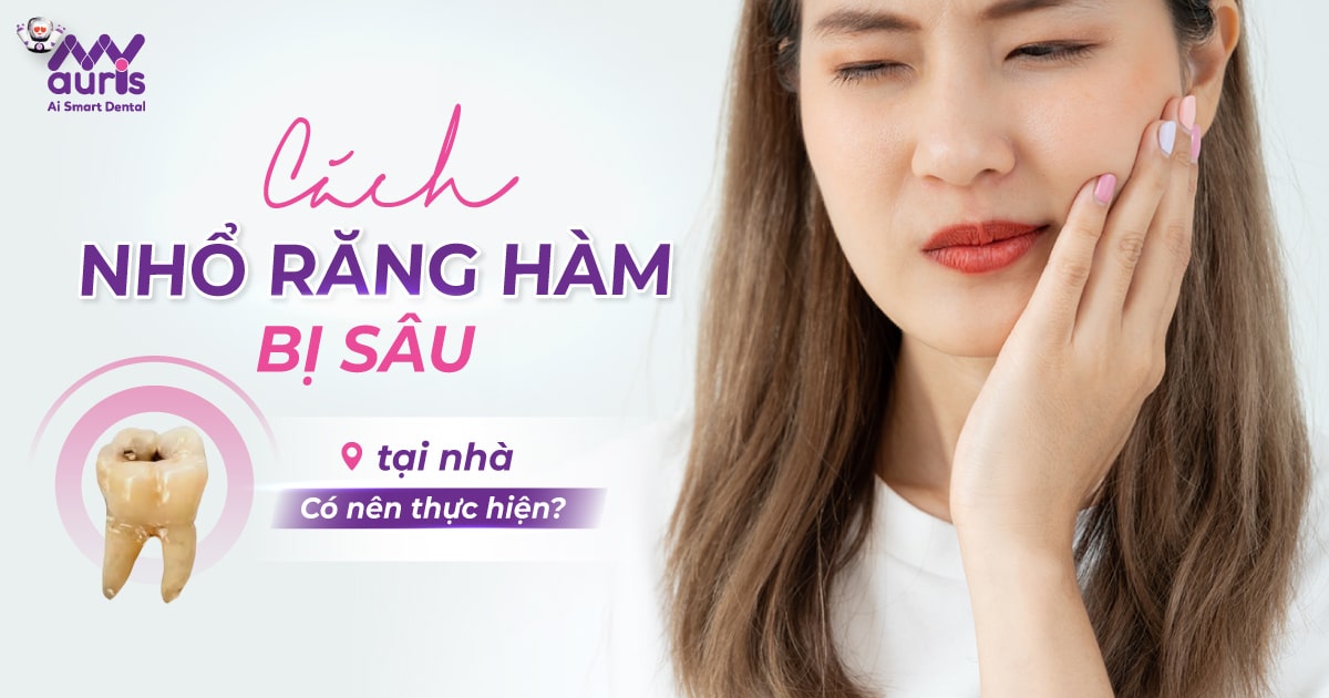 Cách nhổ răng hàm bị sâu tại nhà