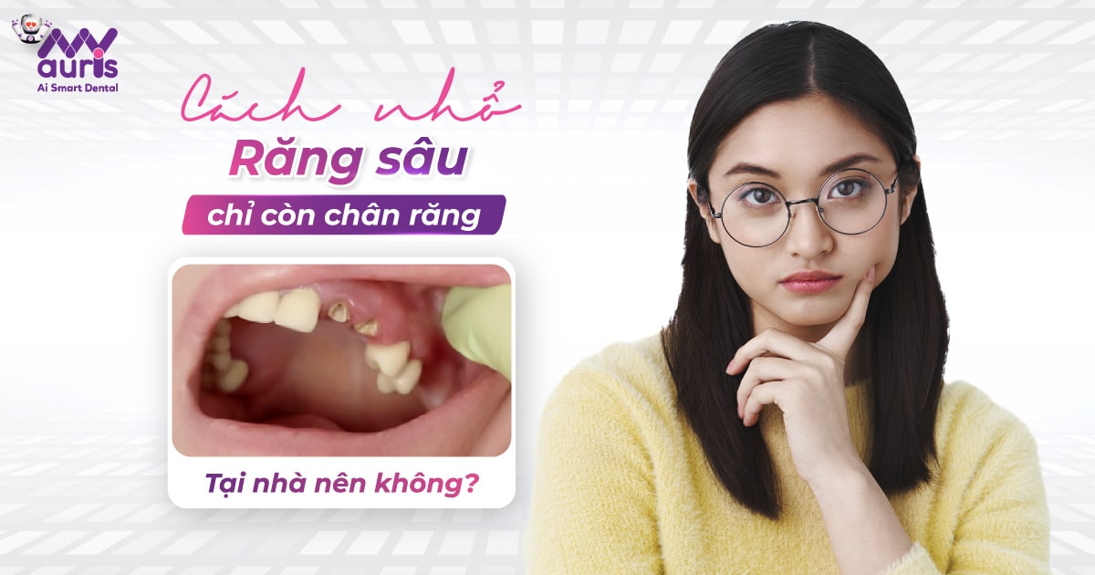 Cách nhổ răng sâu chỉ còn chân răng tại nhà nên không?