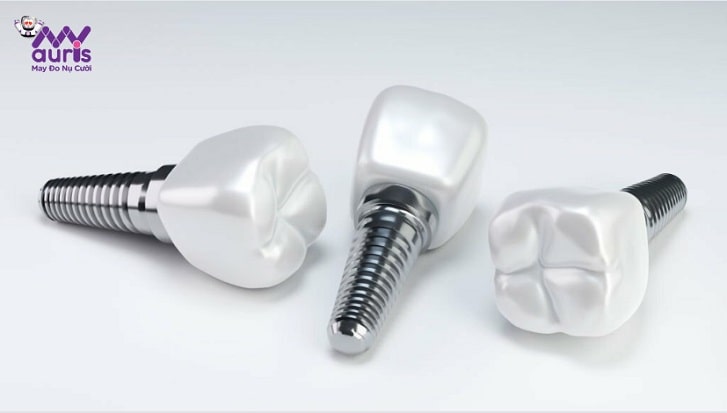 cấy răng implant uy tín
