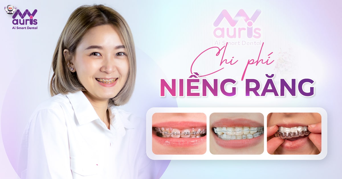 Chi phí cho việc niềng răng - 5 yếu tố ảnh hưởng