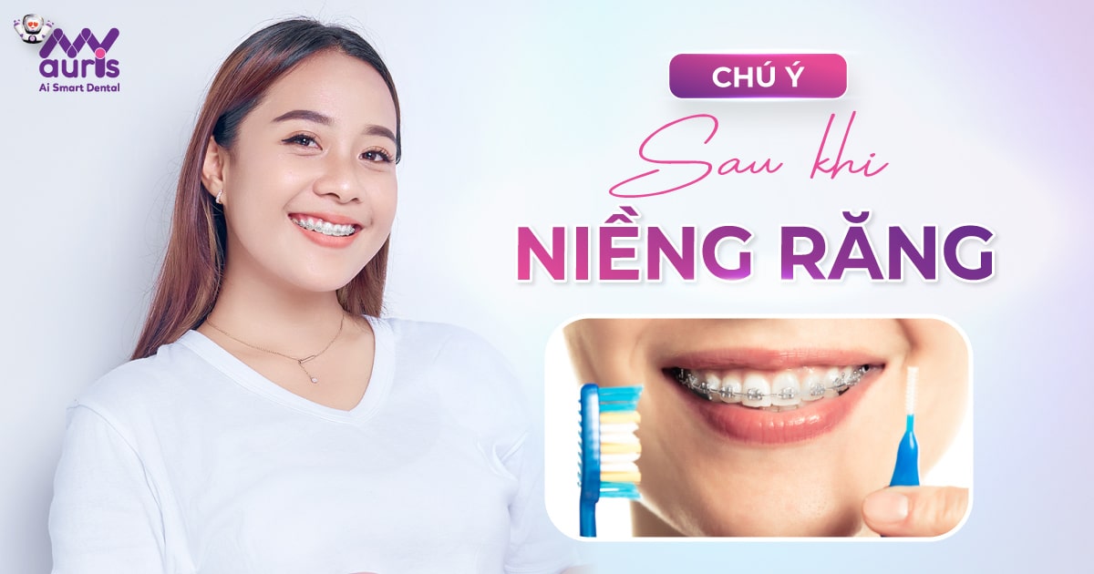 4 điểm cần chú ý sau khi niềng răng mà bạn cần biết