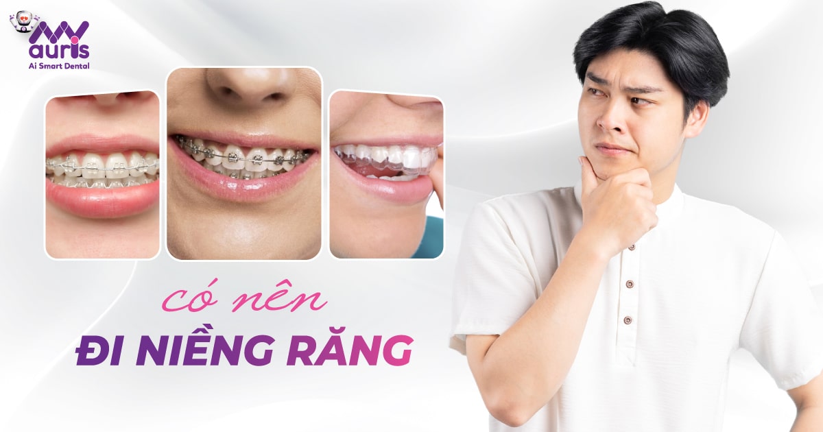 Có nên đi niềng răng không? - Đánh giá qua 5 yếu tố