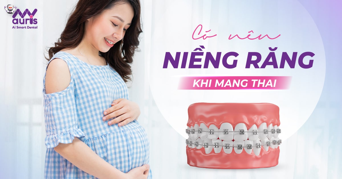 [Bác sĩ tư vấn] Có nên niềng răng khi mang thai?