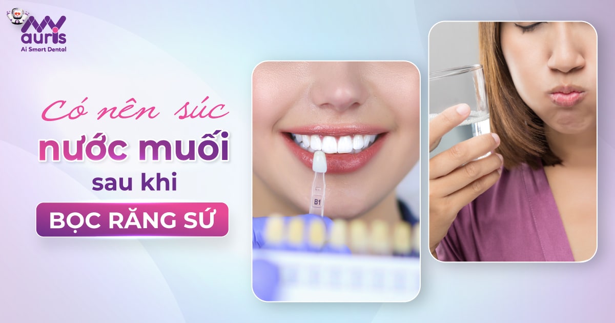 [Chia sẻ] Có nên súc nước muối sau khi bọc răng sứ?