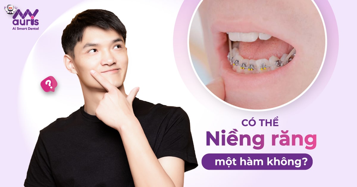 [Chia sẻ] Có thể niềng răng một hàm được không?