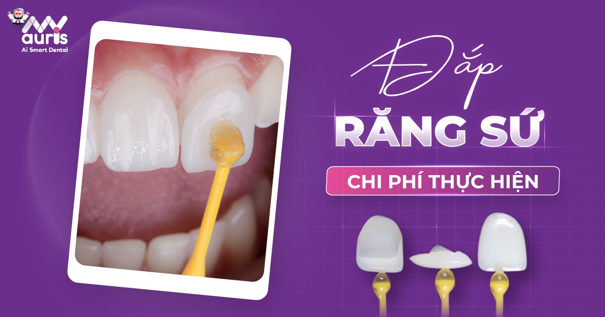 Đắp răng sứ giá bao nhiêu? 3 điểm ảnh hưởng chi phí