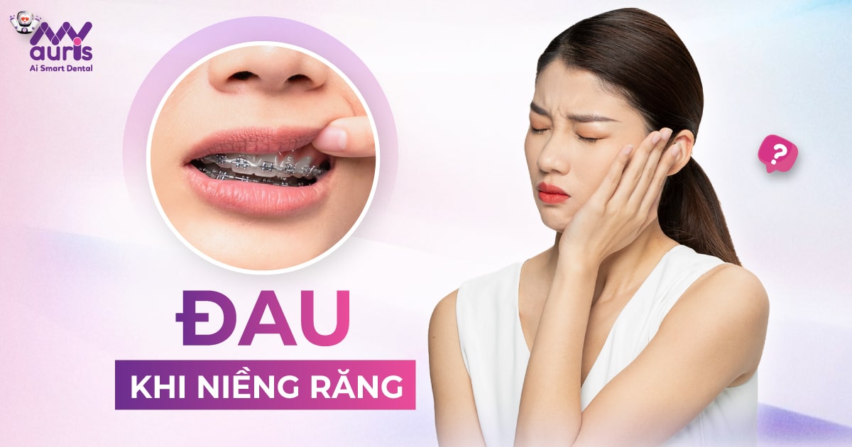 Đau khi niềng răng - 5 cách hỗ trợ giảm đau an toàn