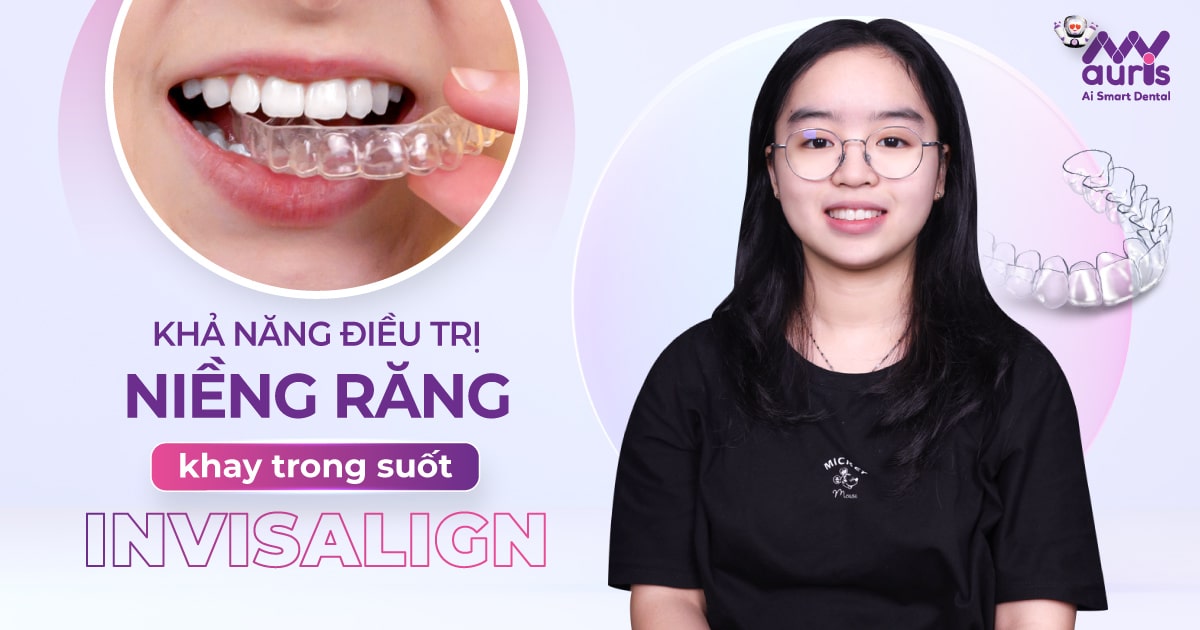 Khả năng điều trị niềng răng khay trong suốt invisalign