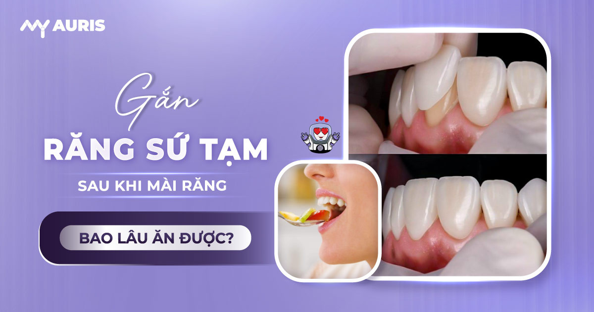 gắn răng sứ,gắn răng tạm sau khi mài răng,răng tạm khi làm răng sứ,gắn răng sứ tạm sau khi mài răng,răng sứ gắn tạm,răng sứ tạm thời