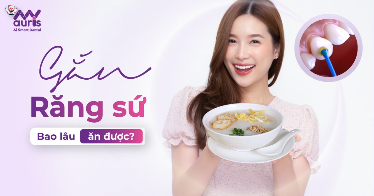 [Tư vấn nha khoa] Gắn răng sứ bao lâu thì ăn được?