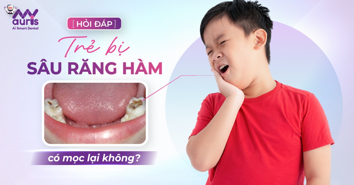 Trẻ bị sâu răng hàm có mọc lại không?