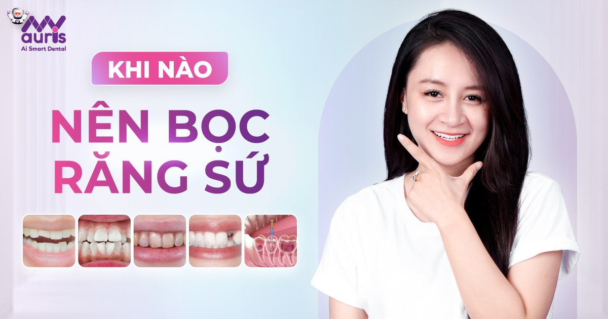 Khi nào nên bọc răng sứ - 7 bước trong quy trình