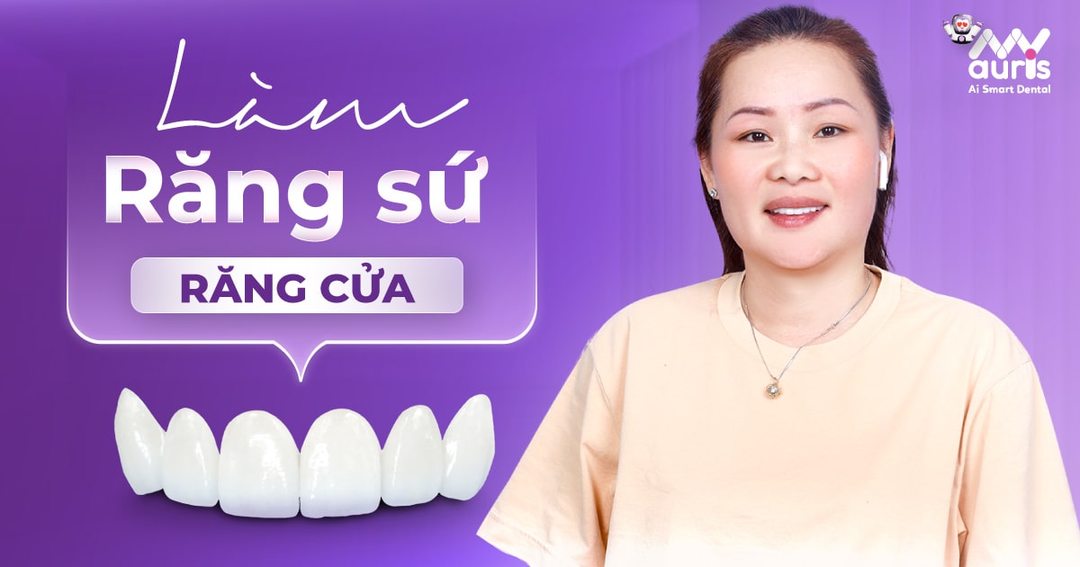 Làm 6 răng sứ cho răng cửa - Nên chọn dòng sứ nào?