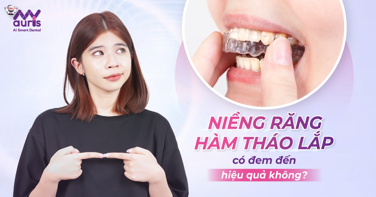 Niềng răng hàm tháo lắp có đem đến hiệu quả không?