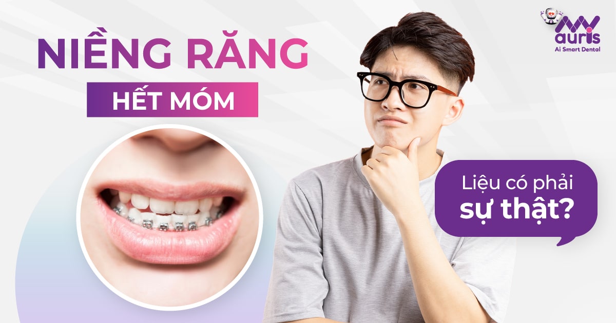 Niềng răng hết móm - liệu có phải sự thật?