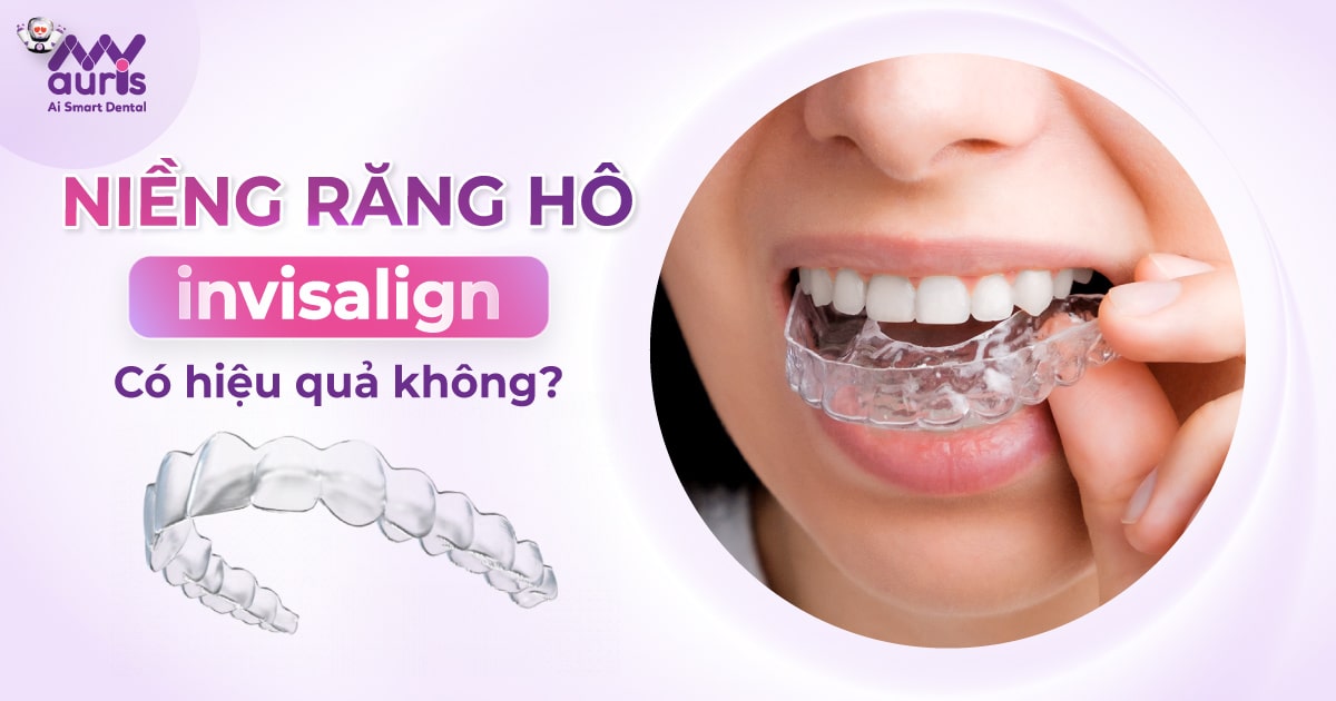 Niềng răng hô invisalign có hiệu quả không?