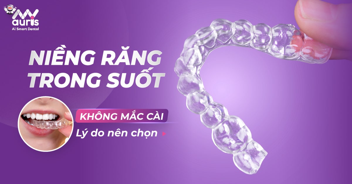 Lý do nên chọn niềng răng trong suốt không mắc cài