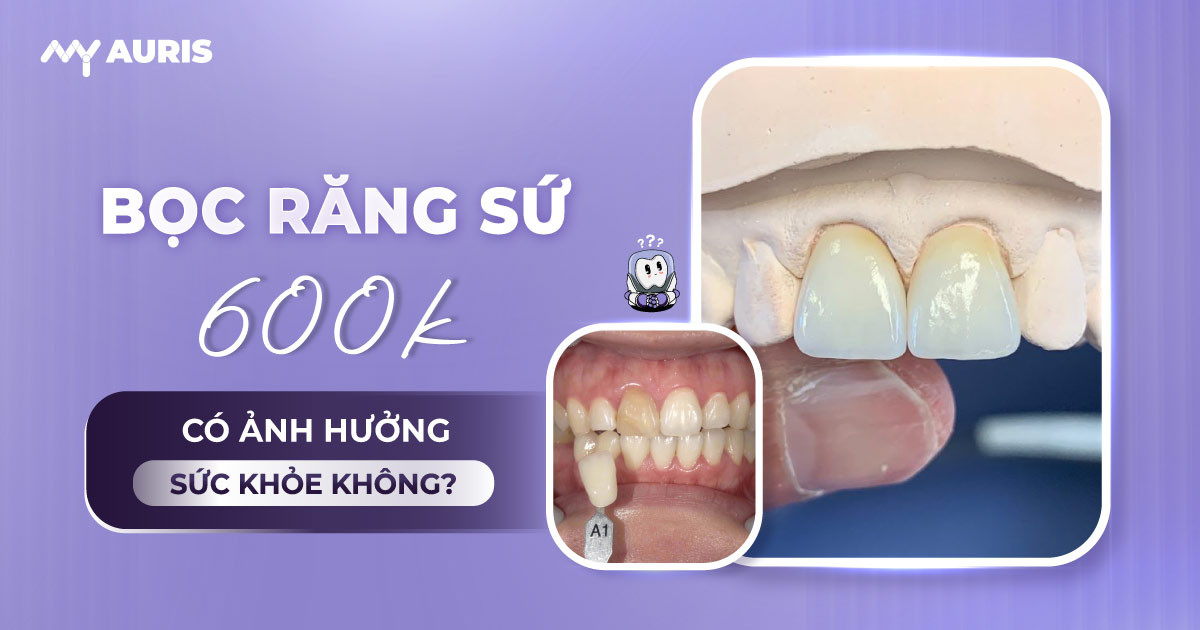 răng sứ 600k