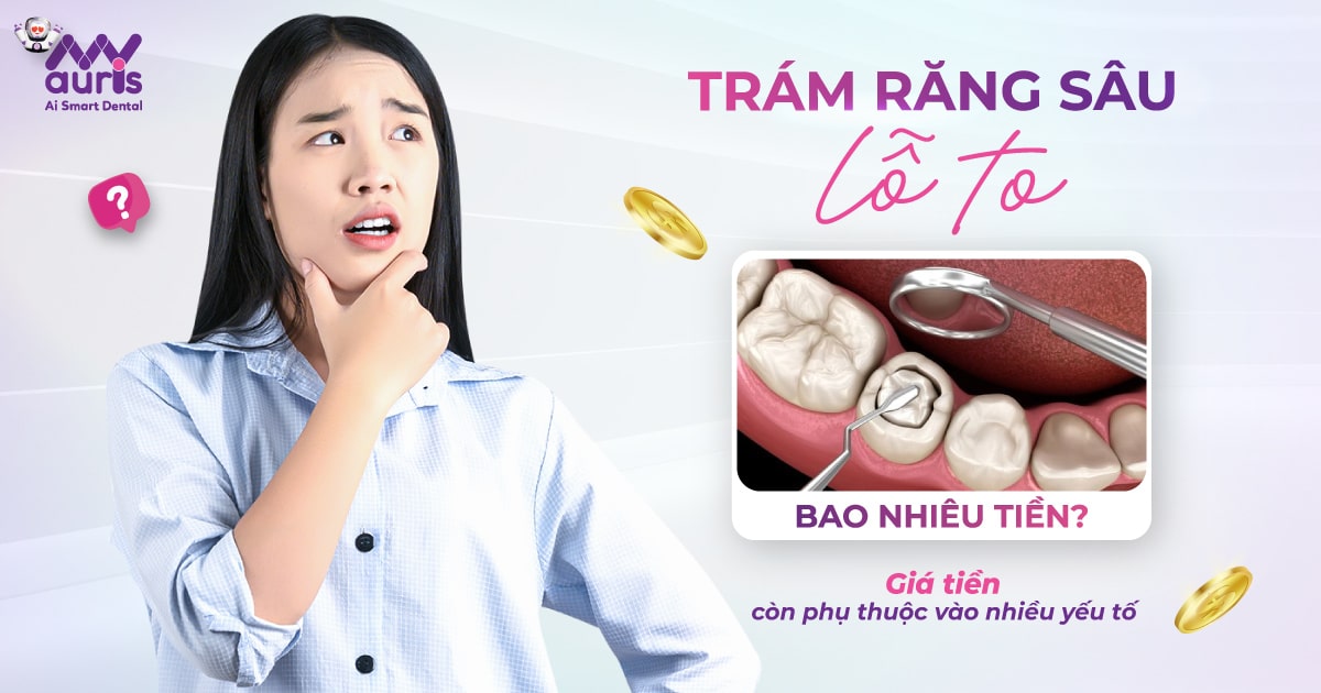 Trám răng sâu lỗ to bao nhiêu tiền