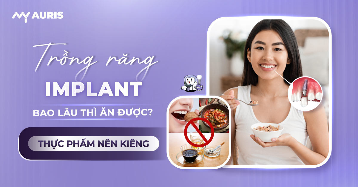 trong-rang-implant-bao-lau-thi-an-duoc-17-3-25