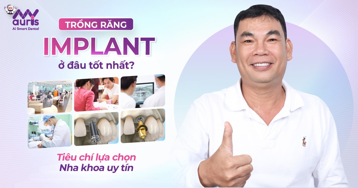 Trồng răng implant ở đâu tốt nhất