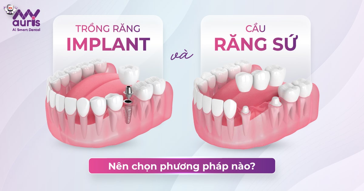 Trồng răng implant và cầu răng sứ