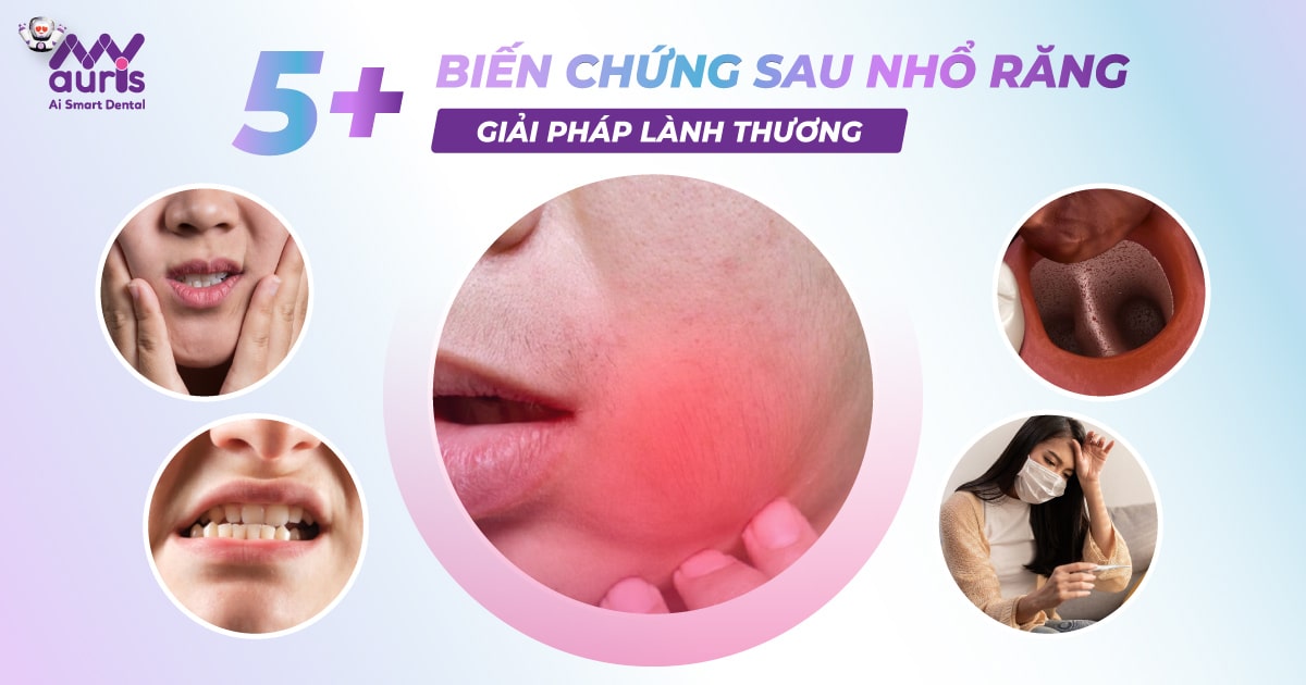 5+ Biến chứng sau nhổ răng