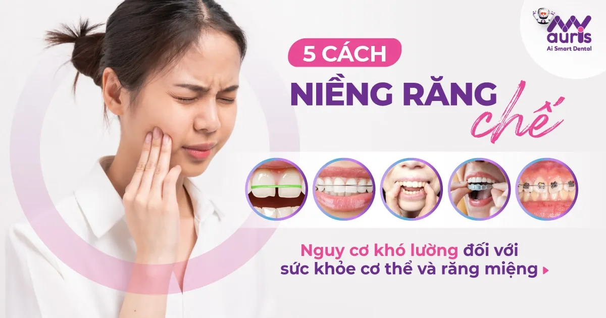 5 cách niềng răng chế