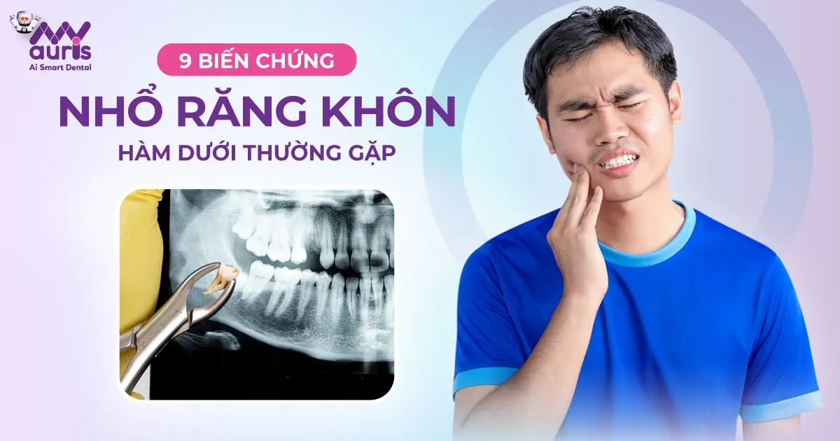 9 biến chứng nhổ răng khôn hàm dưới thường gặp